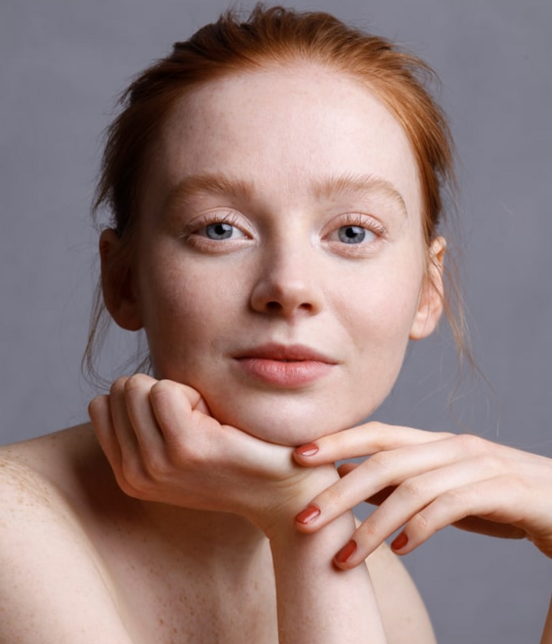 Empfindliche Haut Typen – genetisch empfindliche Haut, Rosazea mit Rötungen, reaktive Haut durch falsche Pflege, allergische Kontaktdermatitis