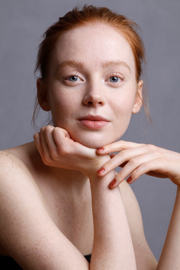 Frau mit strahlender Haut nach Kollagen-Supplementierung"